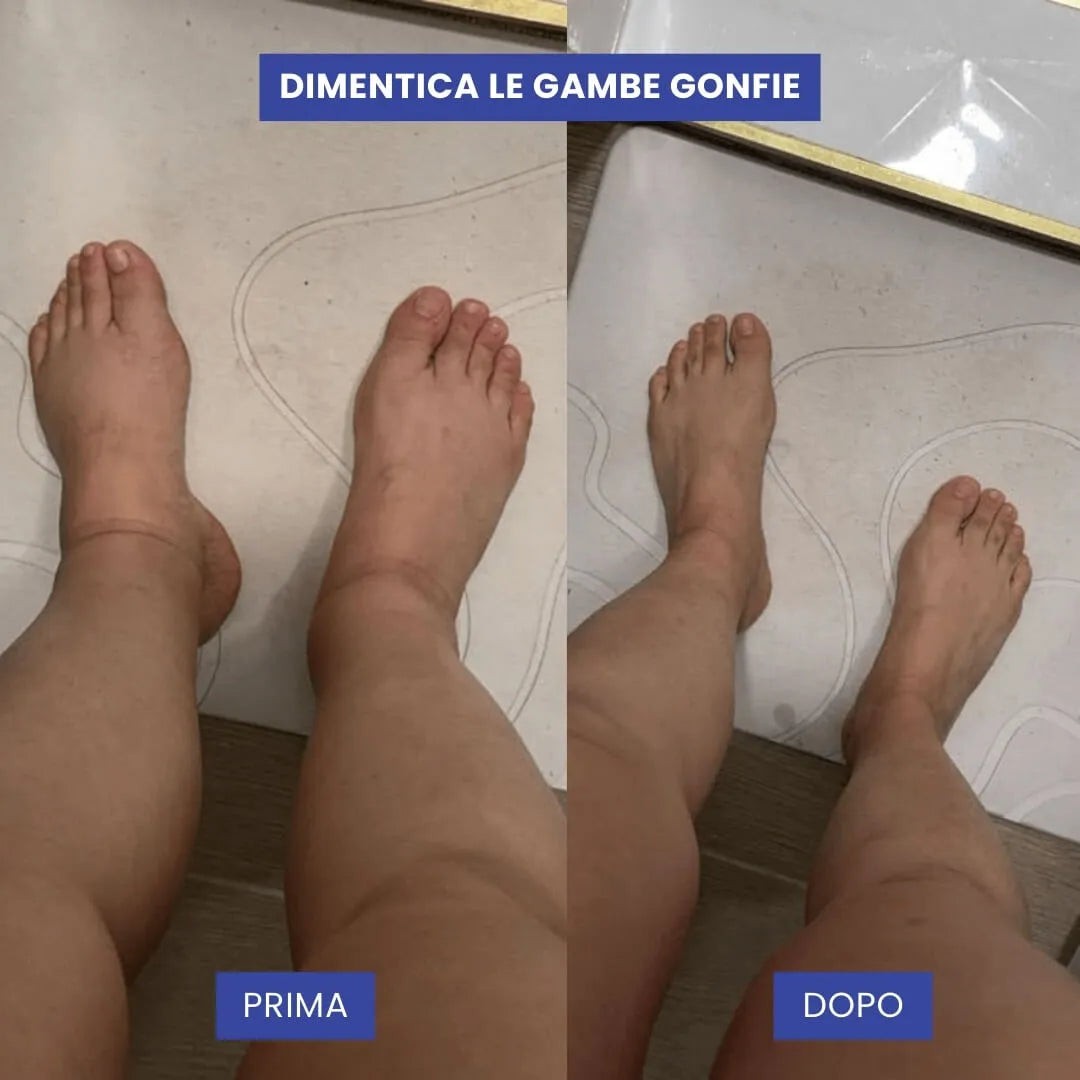 CALCETINES LYSEA DE COMPRESIÓN CON CREMALLERA PREMIUM